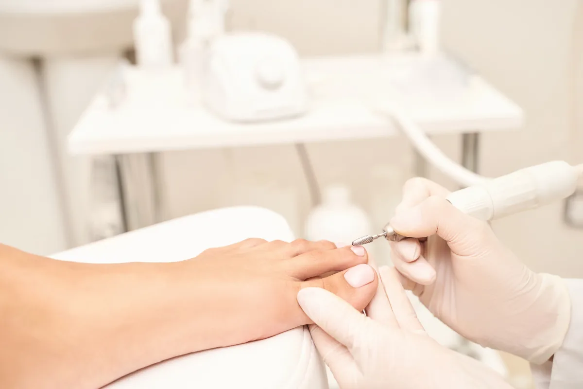 Podologin in Handschuhen behandelt mit einem Fräser den Zehennagel eines Fußes
